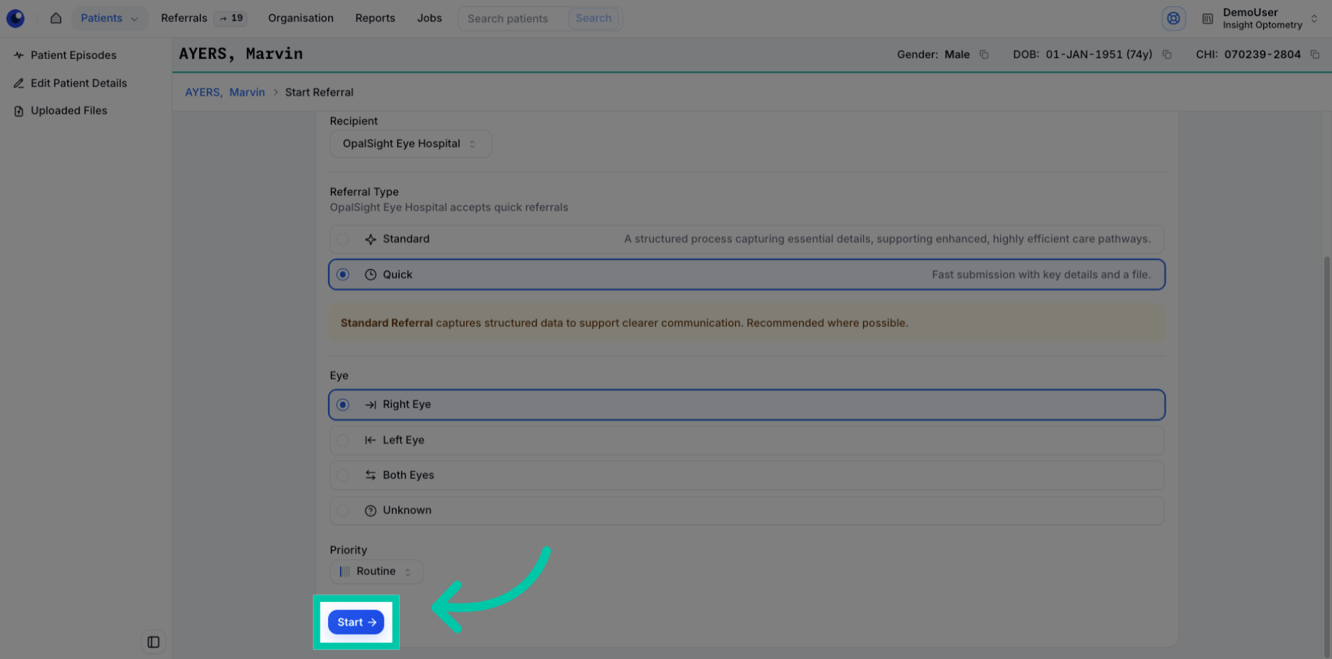 Button labelled ‘Start’ to begin the quick referral process