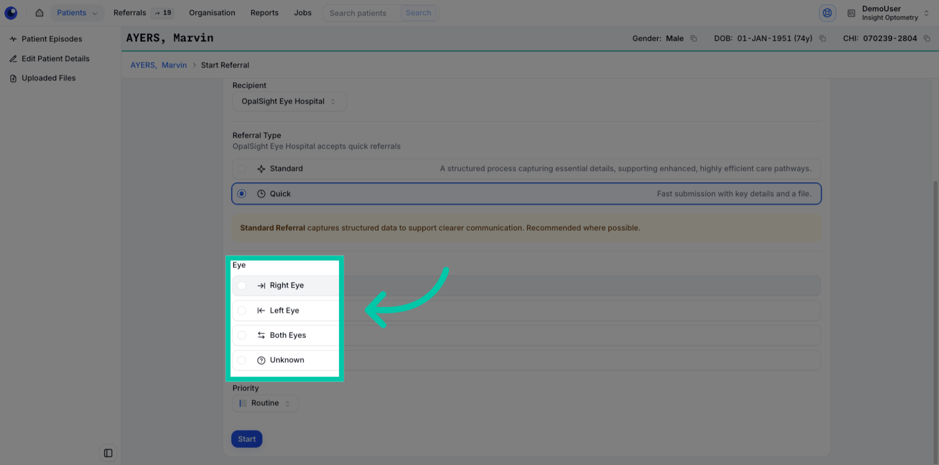 Chooser for selecting which eye the referral relates to