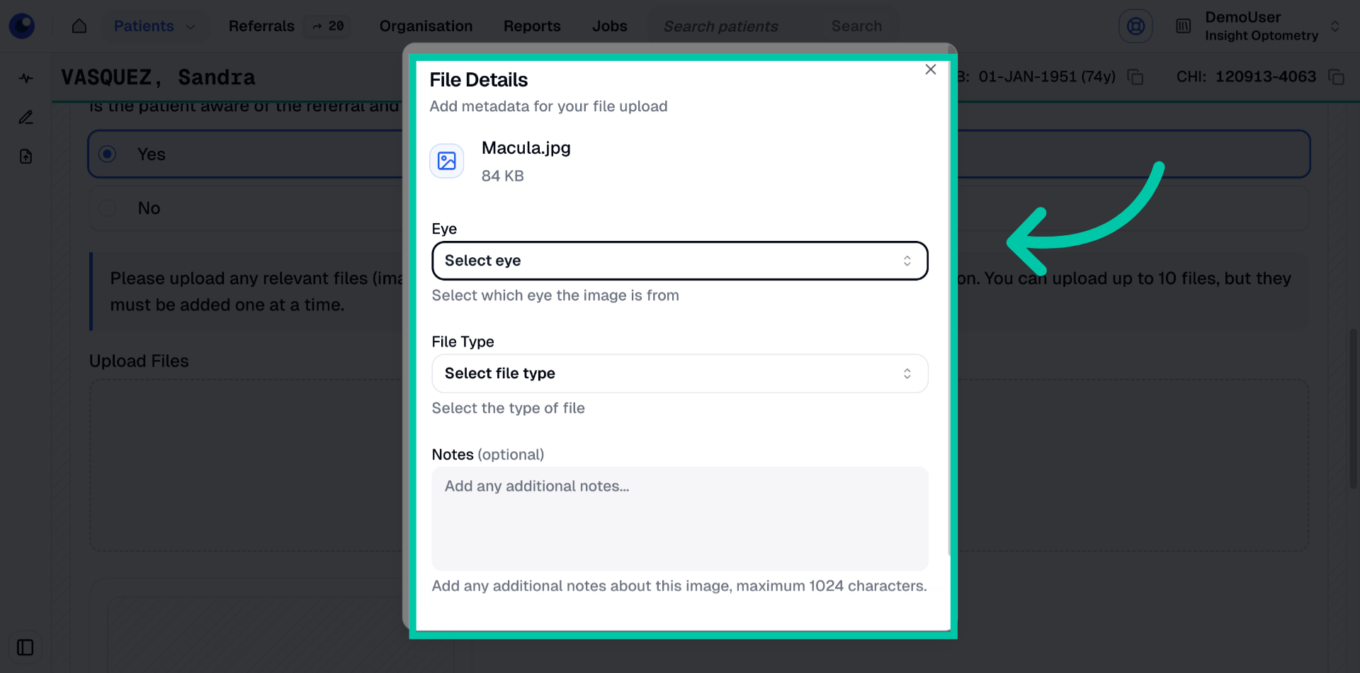 Interface showing uploaded referral file with options to tag eye and file type