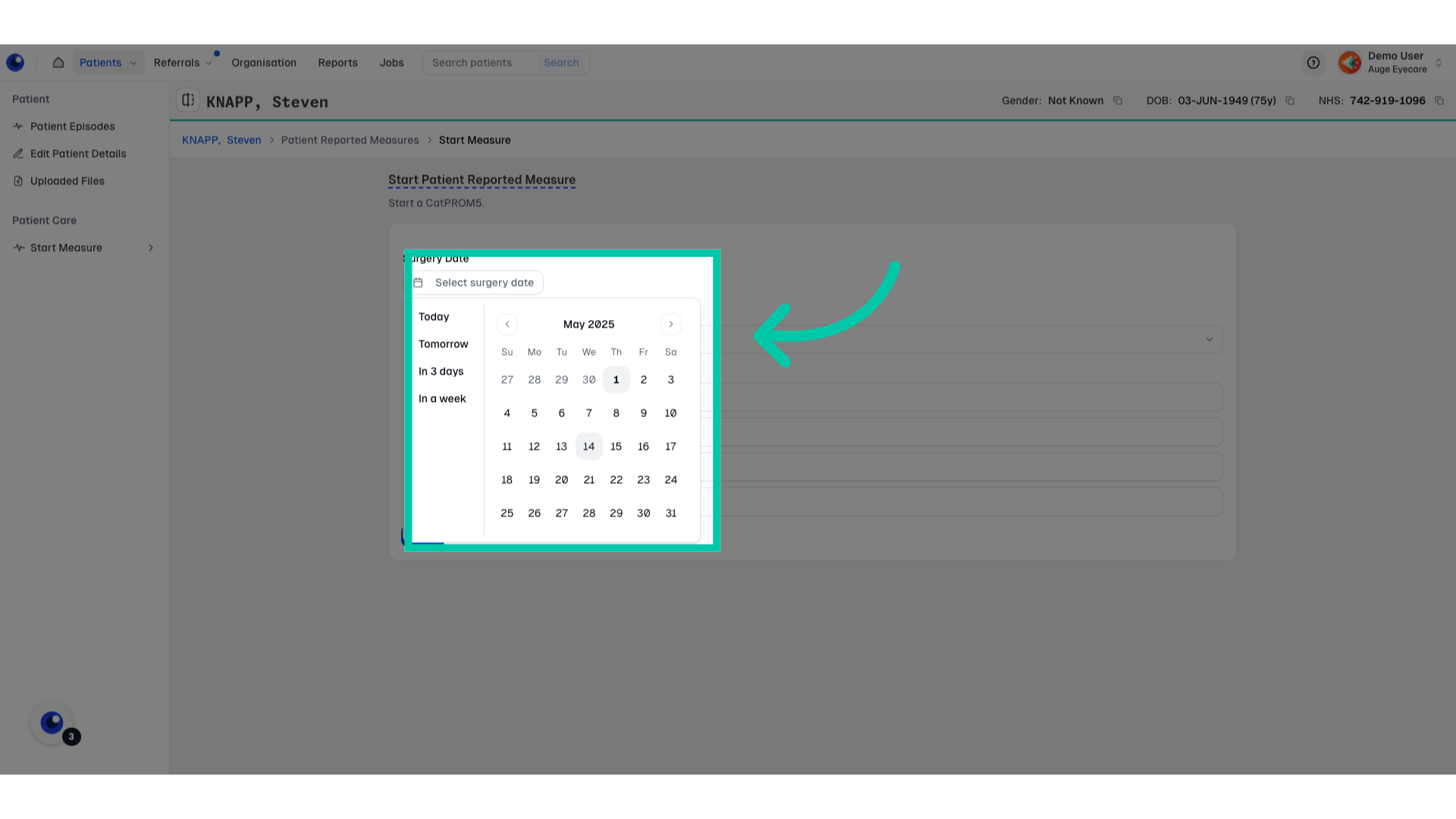 Date picker interface to choose the surgery date for the patient reported measure