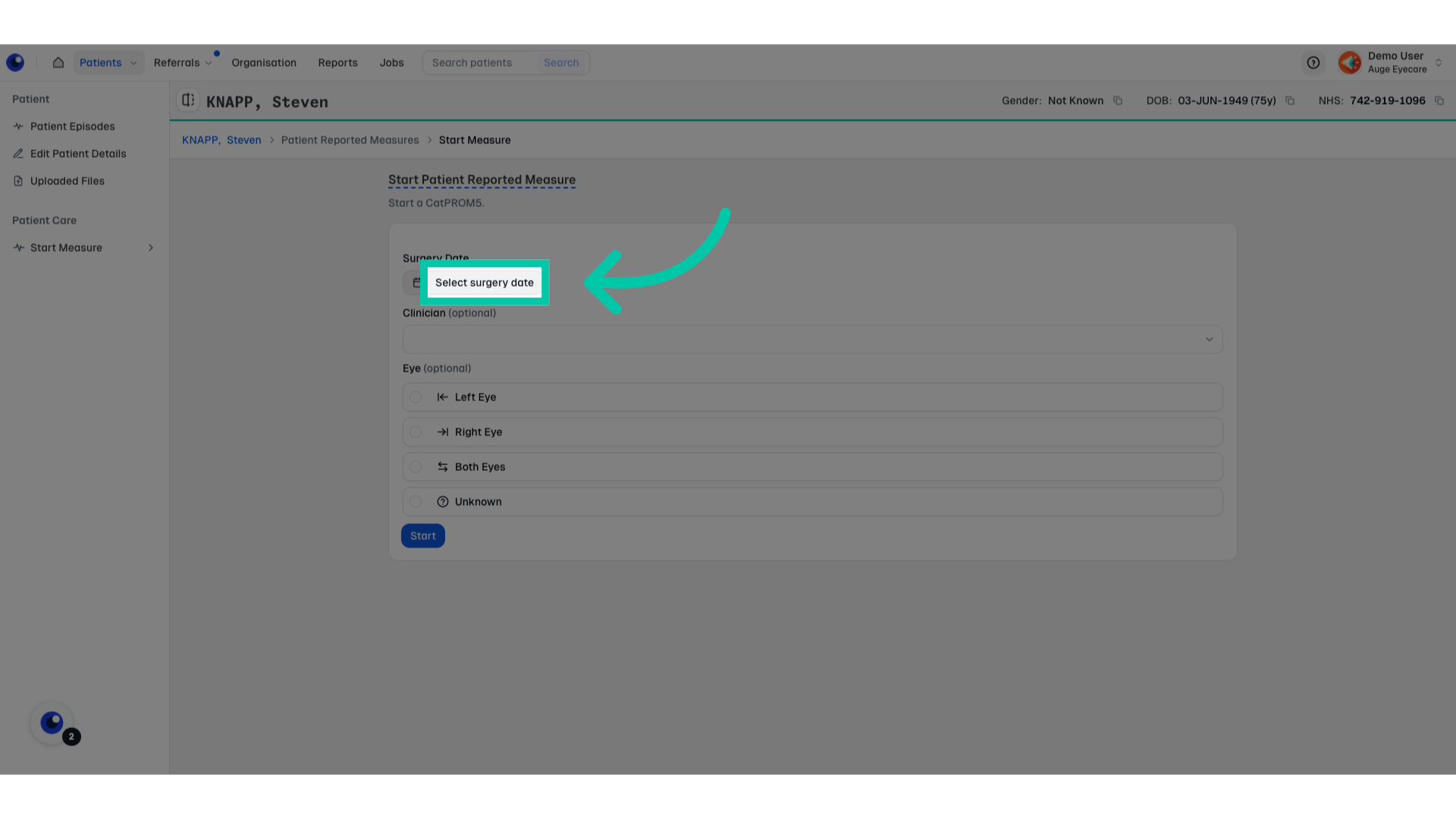 Screen showing field to enter the patient’s surgery date for the measure